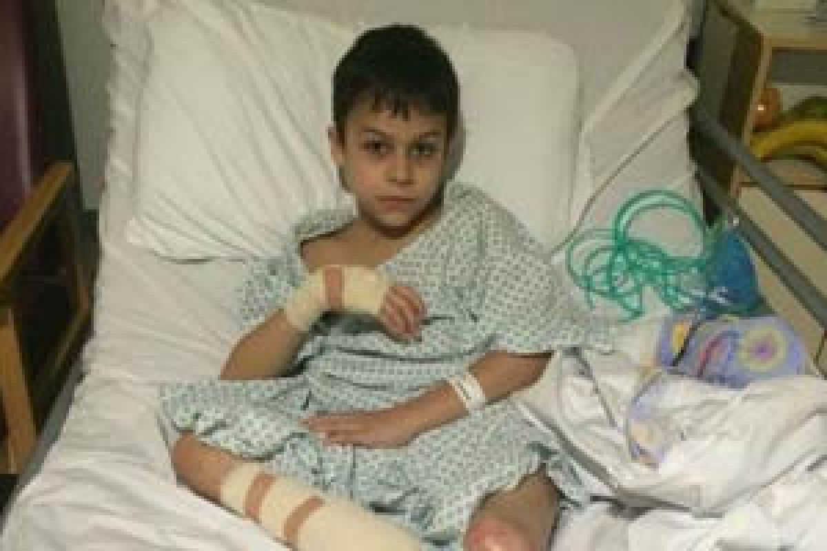 Life changing surgery for war wounded child