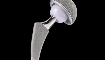 Orthopaedic implants and device technology